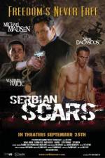 Watch Serbian Scars zumvo