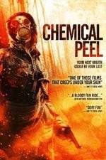 Watch Chemical Peel zumvo