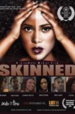 Watch Skinned zumvo